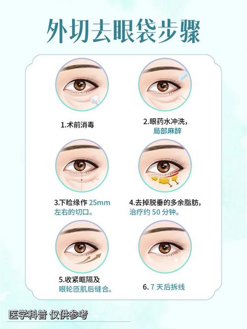 去除眼袋最新方法是什么