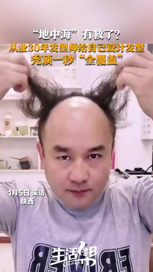 头顶秃留什么发型
