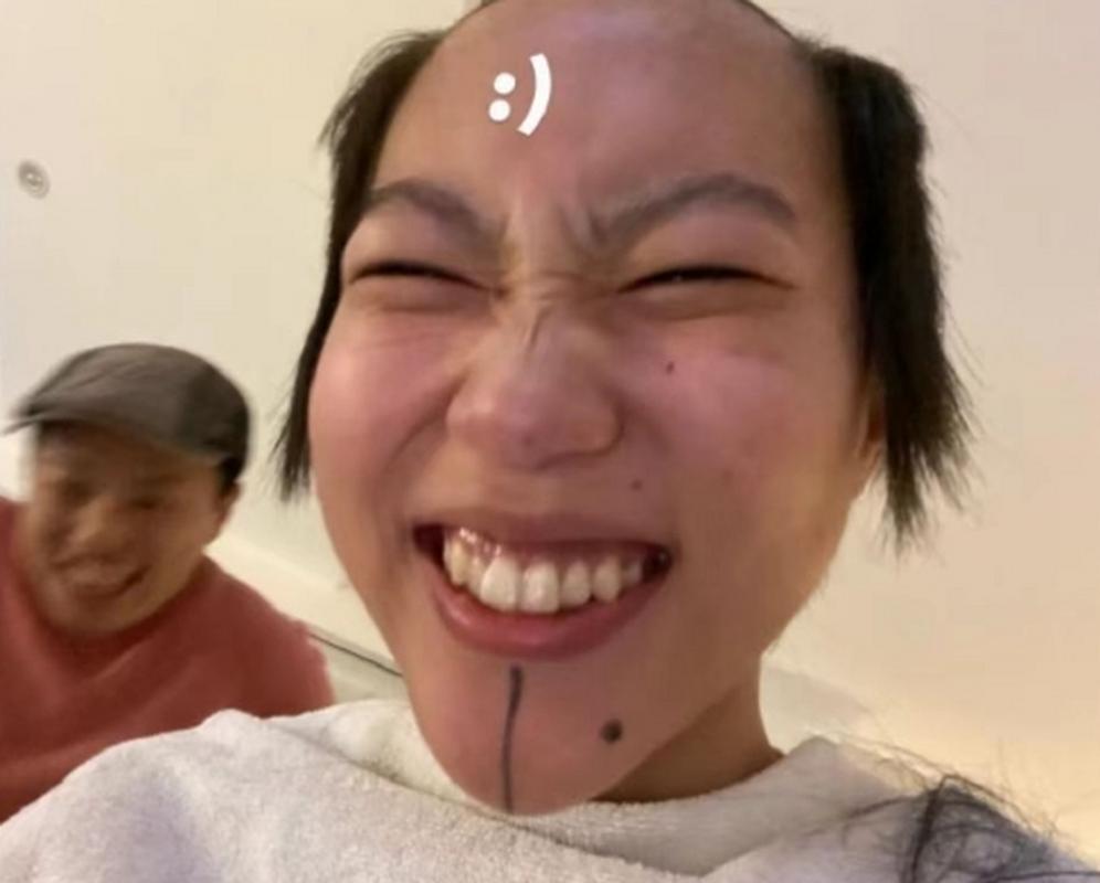 头顶秃留什么发型