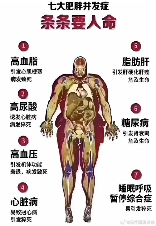 什么病会导致发胖