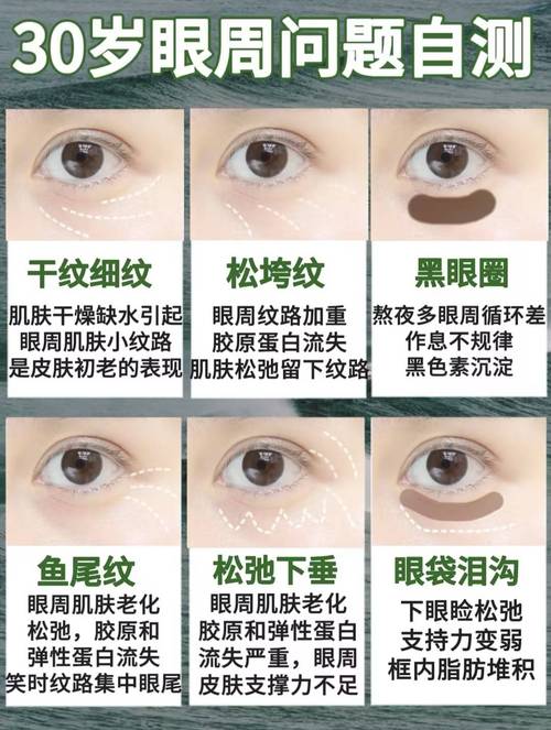 什么眼霜去眼袋最好