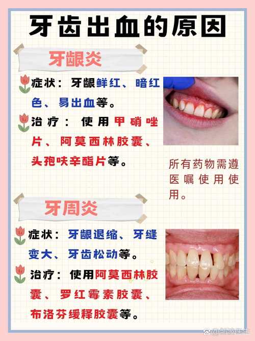 牙齿为什么经常出血