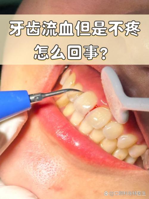 牙齿为什么经常出血