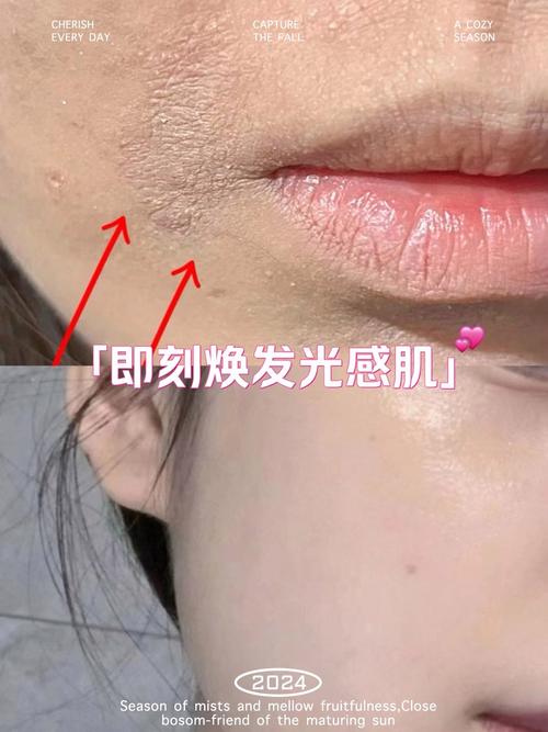 为什么秋天干燥