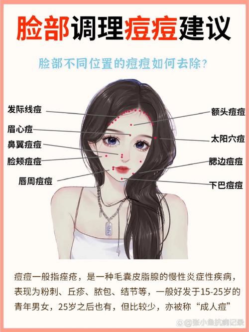两颊长痘痘是什么原因