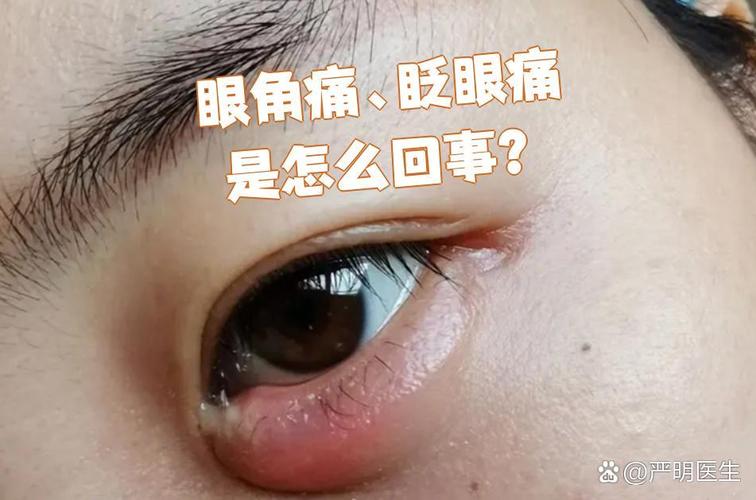 上眼皮痛是什么原因