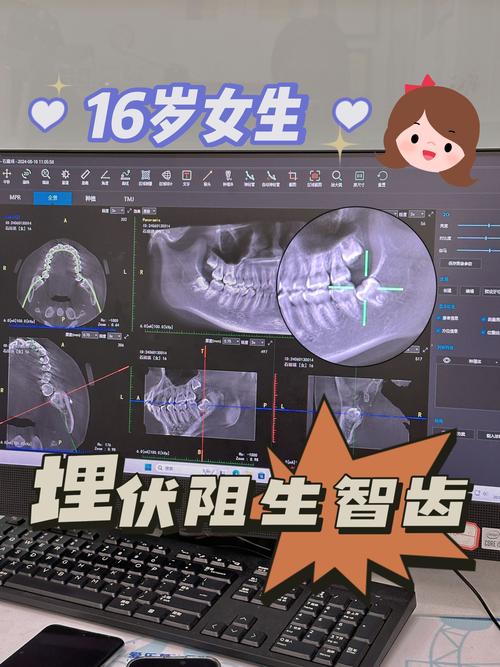 什么样的牙需要拔掉