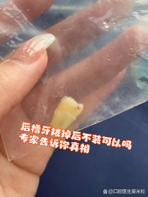 什么样的牙需要拔掉