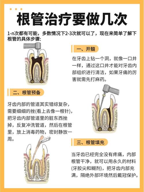 根管治疗有什么用