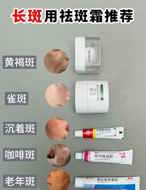 有什么方法可以祛斑