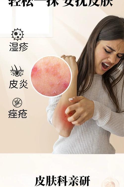 皮肤过敏可以擦什么
