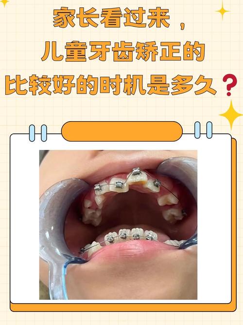 牙齿矫正什么时候最好