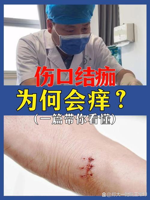 掉痂是什么意思