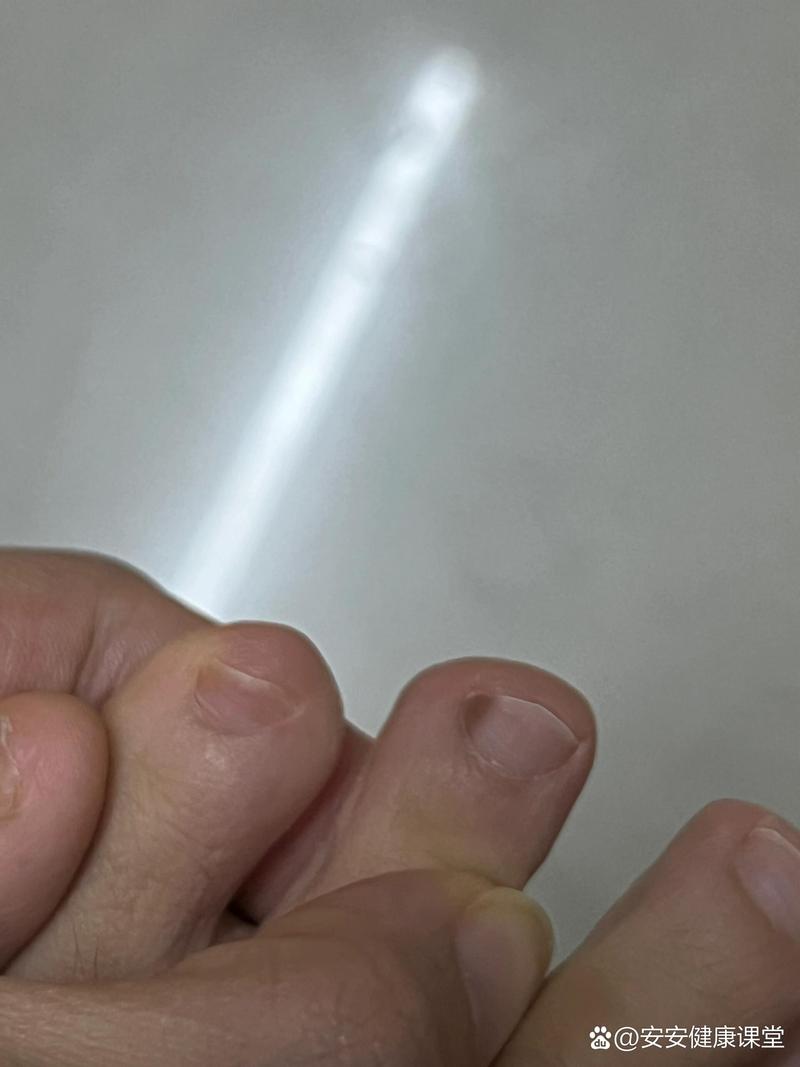 黑指甲是什么症状