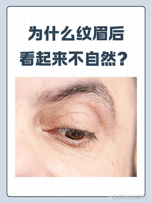 纹眉毛有什么危害