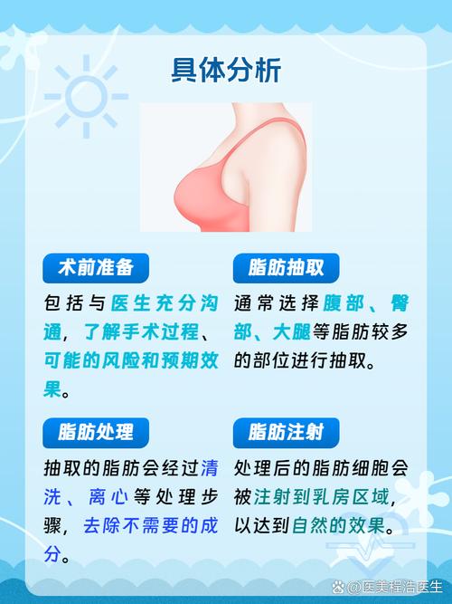 最新丰胸手术方法是什么