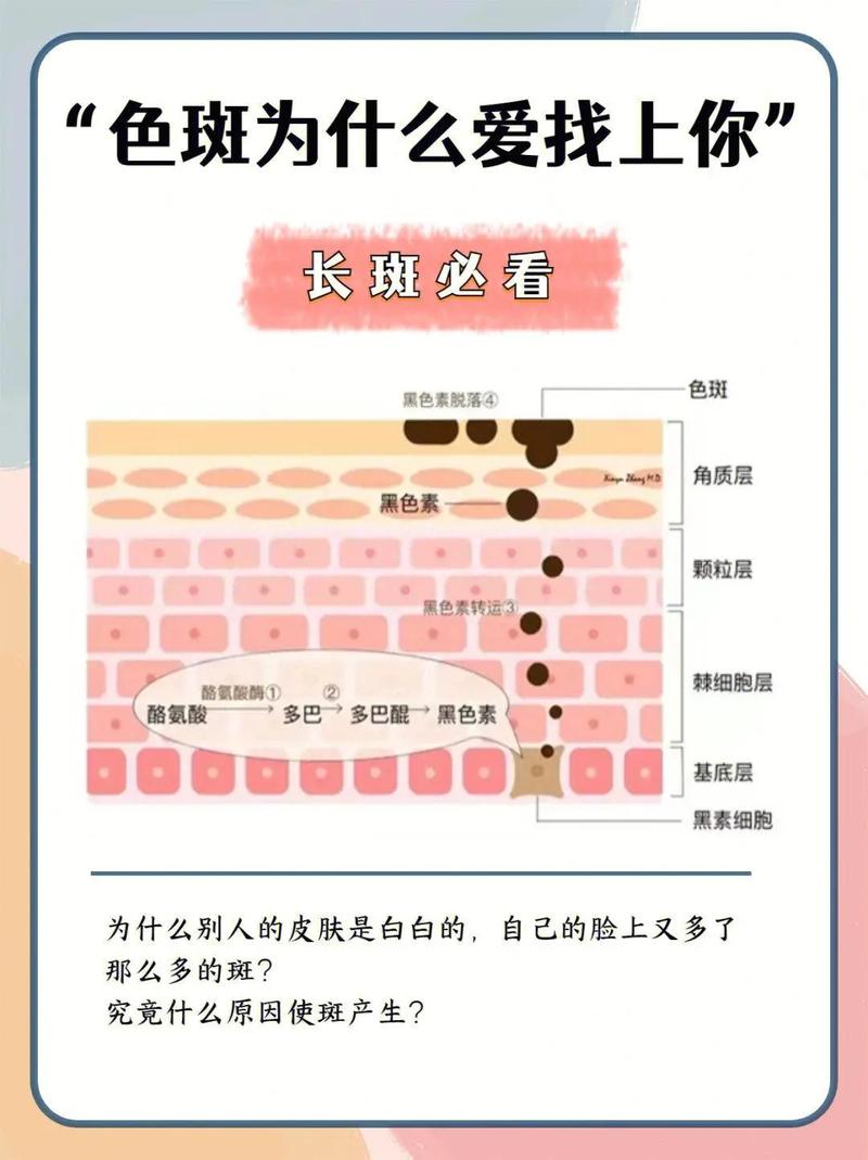 为什么开始长斑