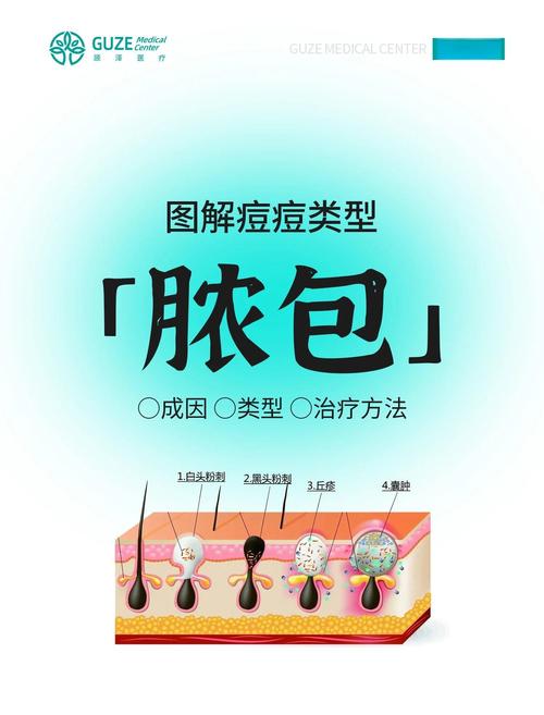 痘痘为什么会化脓