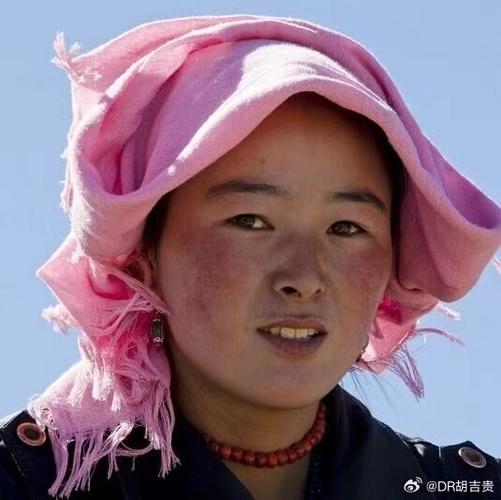 为什么会有高原红