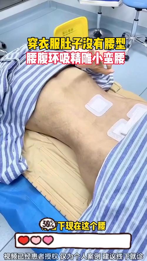 腰肚是什么