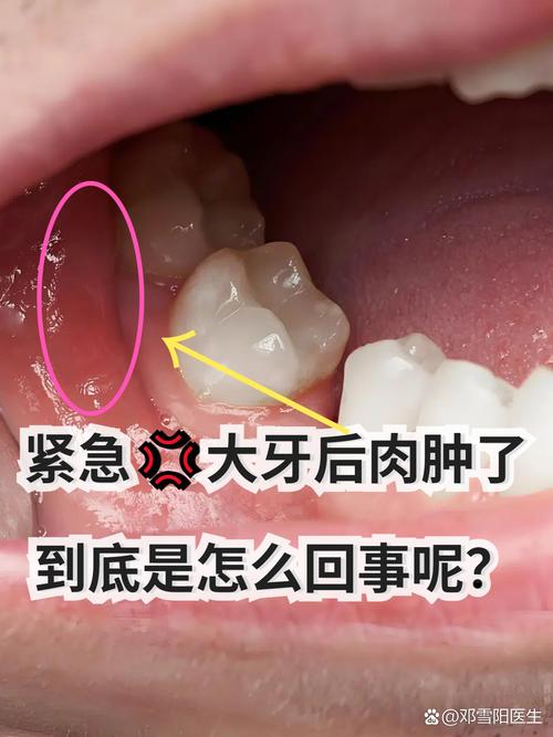 牙后面是什么