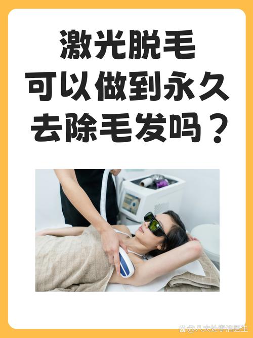 什么是永久脱毛