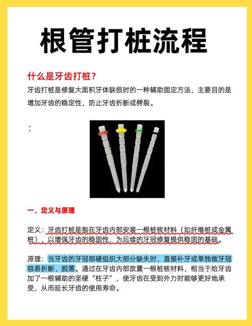 什么是牙齿打桩