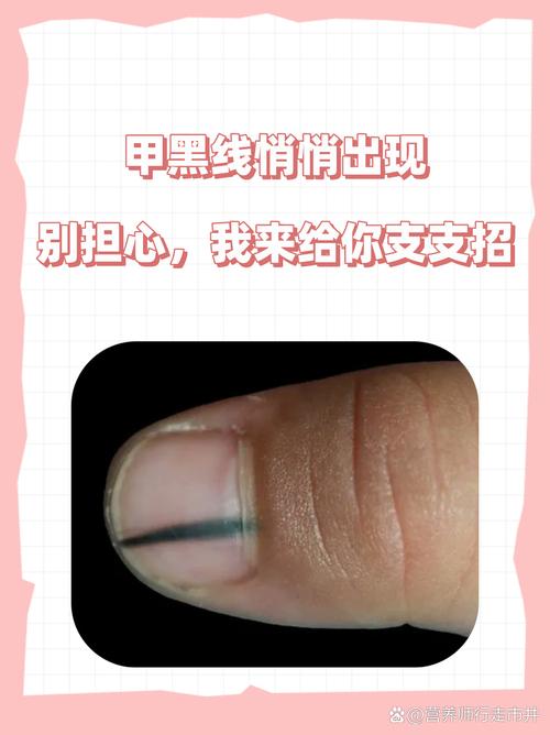 甲线是什么
