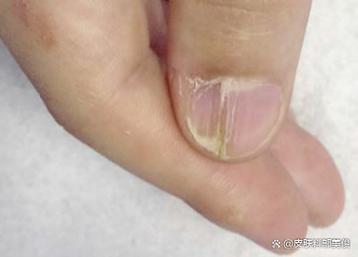 甲线是什么