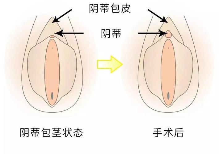 小阴唇是什么样的