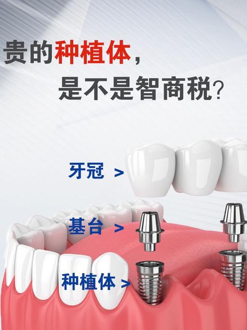 为什么种植牙这么贵
