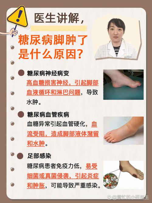 男人脚肿是什么病