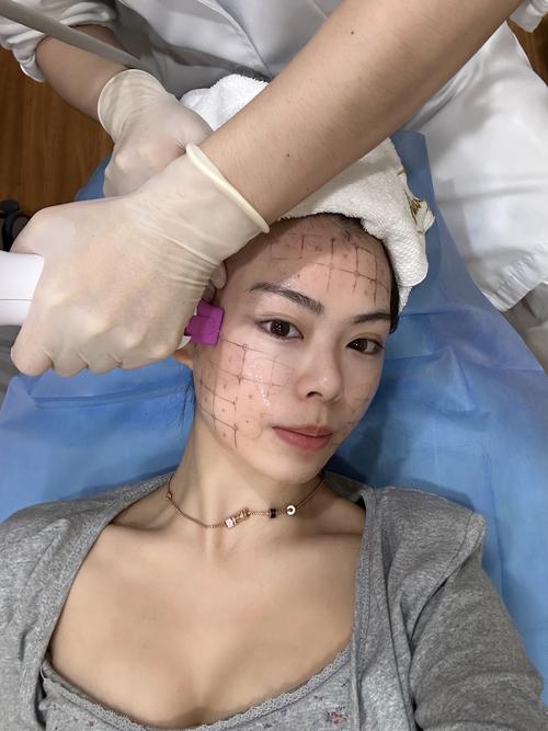 美容热玛吉是什么