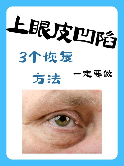 眼皮凹陷是什么原因