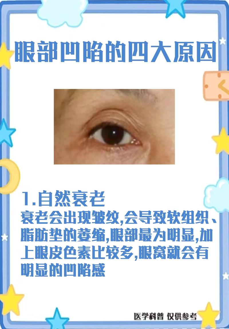 眼皮凹陷是什么原因