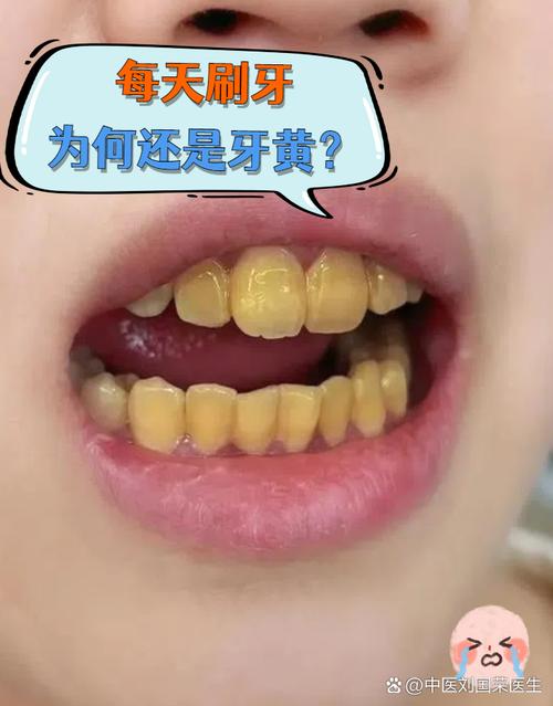 牙齿上黄黄的是什么