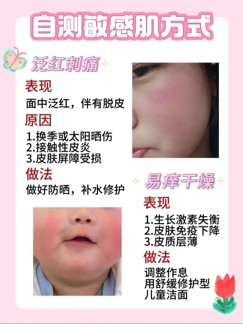 洗面奶过敏了怎么办