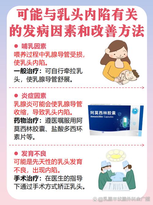 乳头凹陷挂什么科