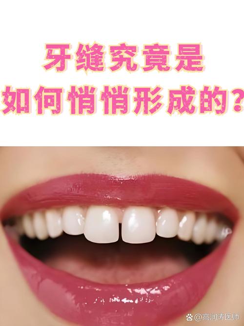 门牙有缝代表什么
