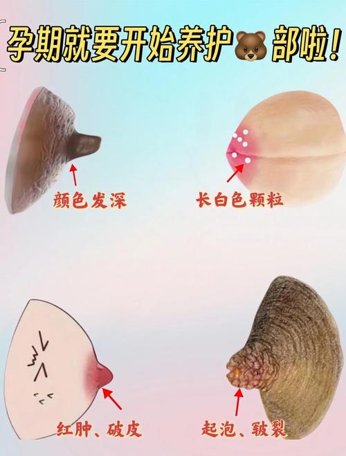 乳晕大为什么