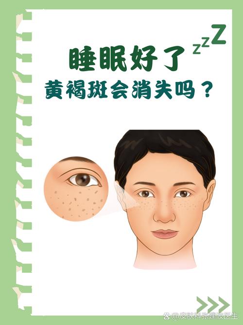 最新睡眠祛斑是什么