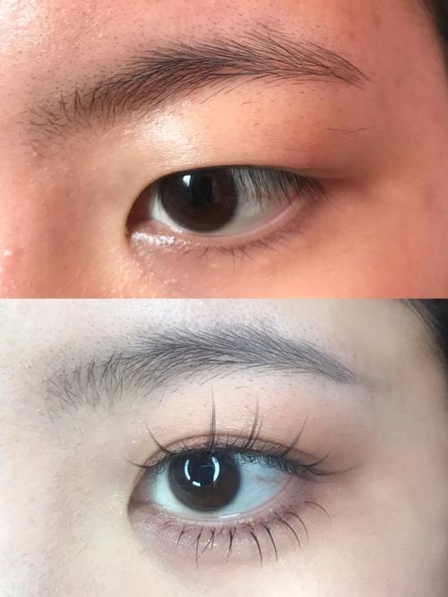 泡眼是什么