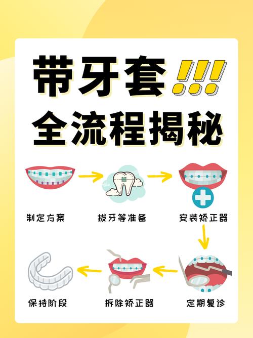 带牙套需要注意什么