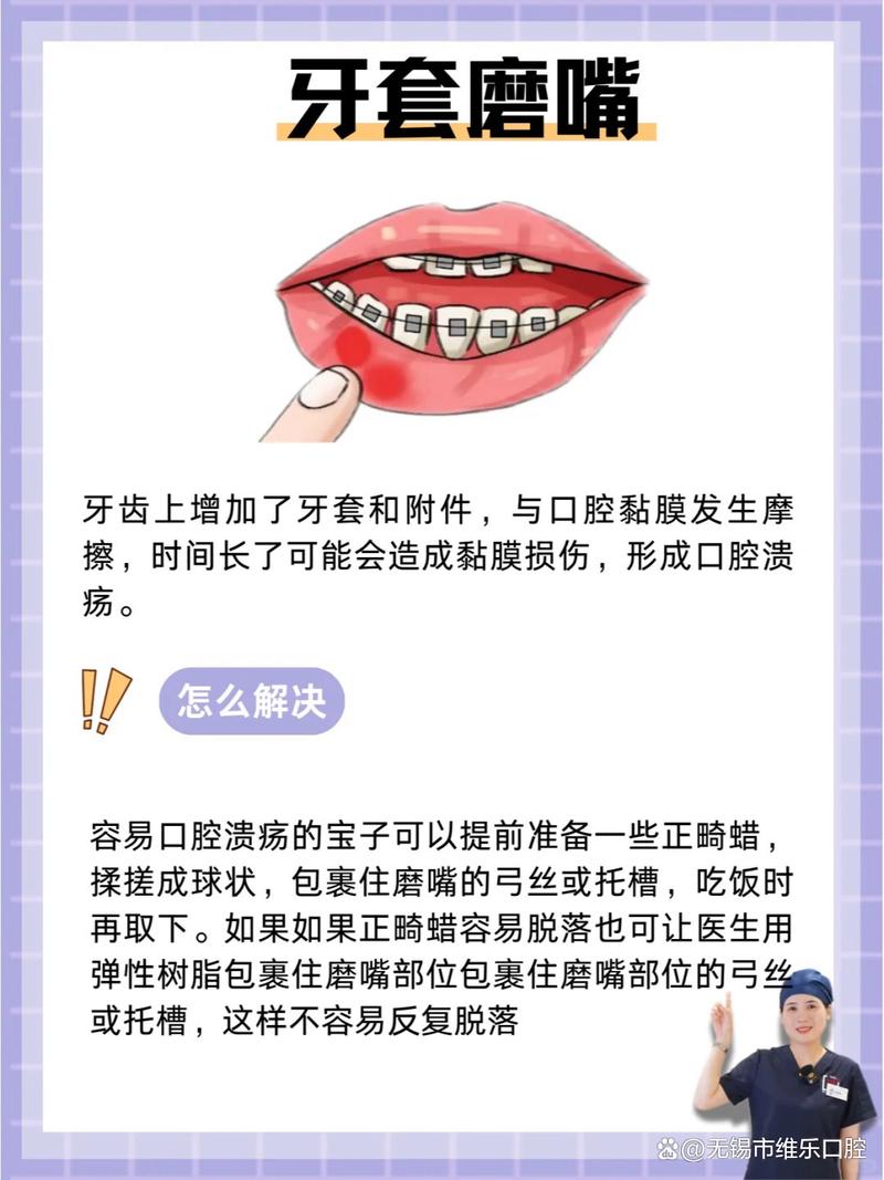 带牙套需要注意什么