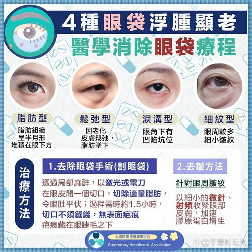 下眼袋肿是什么原因