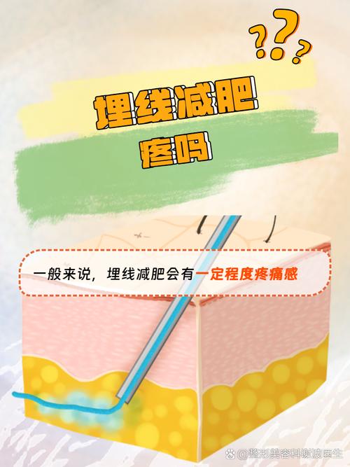 埋线减肥后会有什么反应
