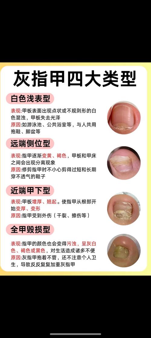 鬼指甲怎么折最新