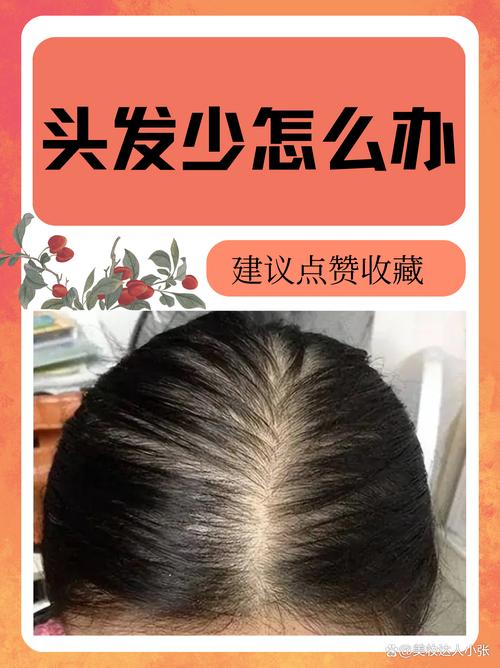 为什么头发越长越少