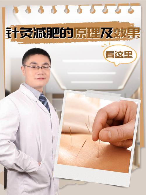 针灸减肥原理是什么