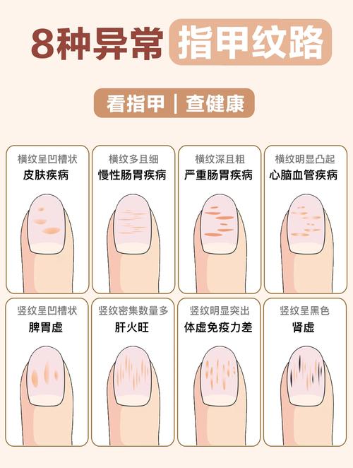 指甲问题看什么科